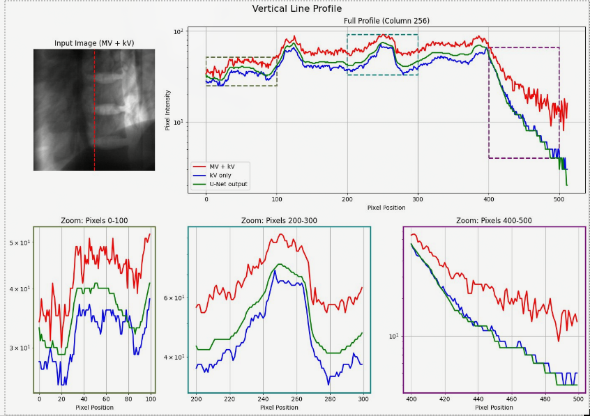 Vertical line-profile analysis of radiation images